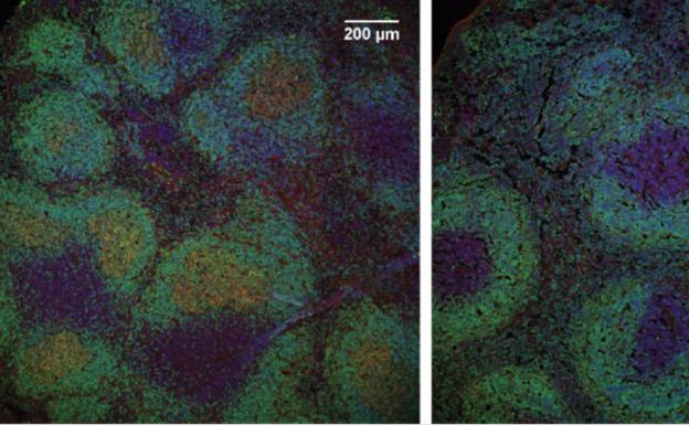 Imagen representativa del centro germinal (rojo) en ratones control (izquierda) y deficientes para CTCF (derecha).