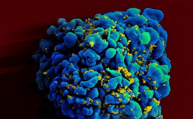 Escaneo electromicrográfico de una célula T H9 infectada por VIH.