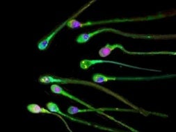 El semen los españoles, el peor de Europa pero el más efectivo